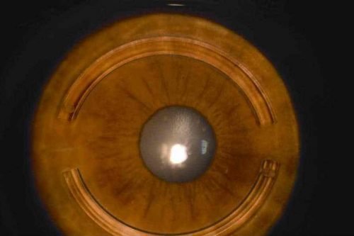 AA0_5260