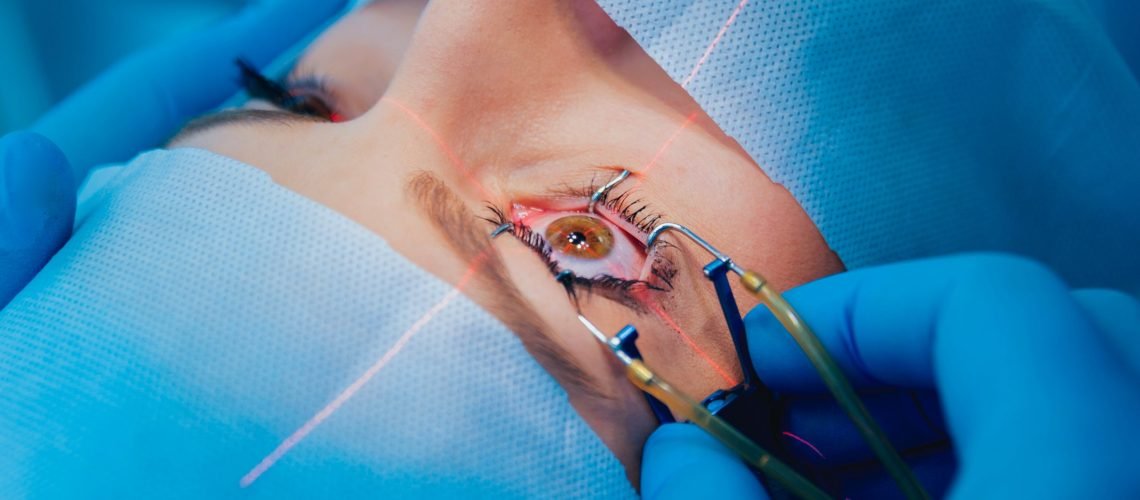 Cirurgião oftalmologista realizando cirurgia refrativa a laser em paciente